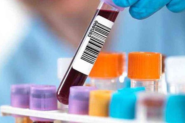 Ссылки на сайты в даркнете